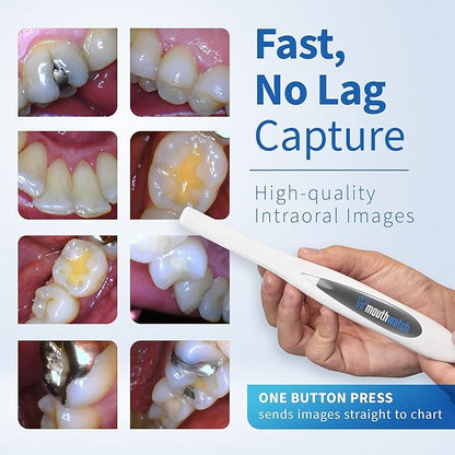 MouthWatch Intraoral Camera, Crystal Clear Images