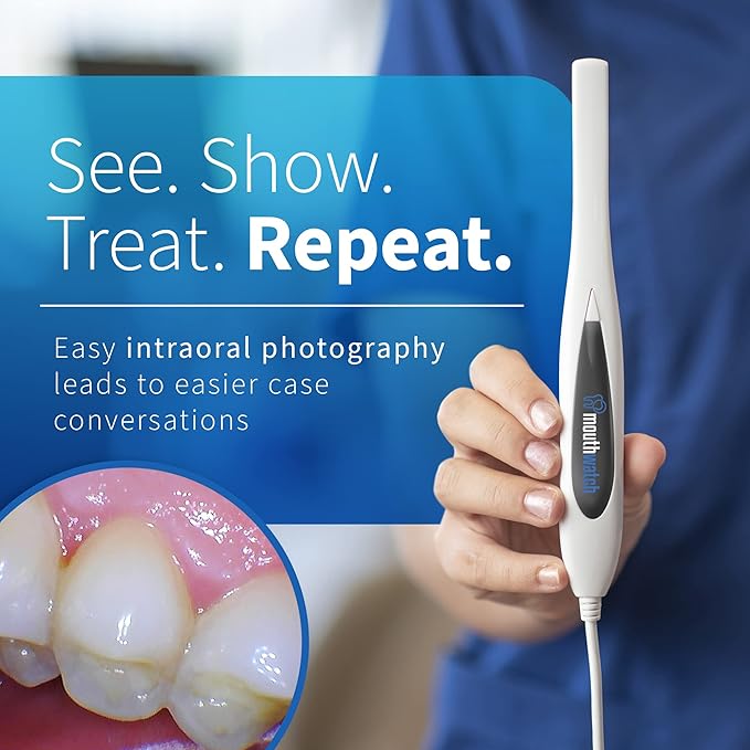 MouthWatch Intraoral Camera, Crystal Clear Images
